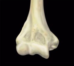 mri mastery series elbow 510x456 1