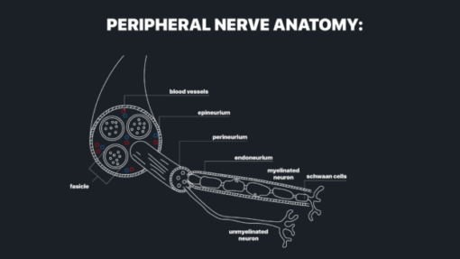 MRI Online MRI Mastery Series: Nerve Imaging – Entrapment Neuropathy and Tumor Imaging of Nerves 2021 nerve injuries graphic1 1 624x351 1 510x287 1