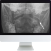 Neuroradiology Review for the Practicing Radiologist 2018 (ARRS VIDEOS) neuroradiology review for the practicing radiologist 2018