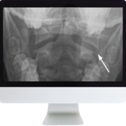 neuroradiology review for the practicing radiologist 2018