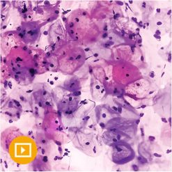 oakstone gynecologic pathology 2022