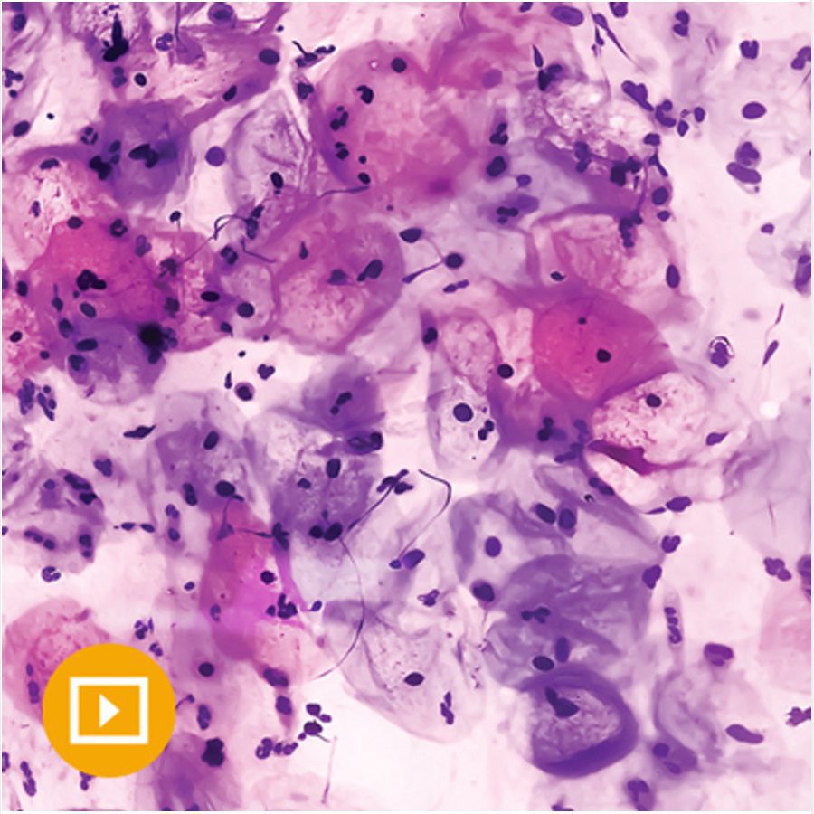 Oakstone Gynecologic Pathology 2022 oakstone gynecologic pathology 2022