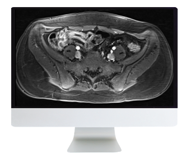 ARRS A Guide to Bowel Imaging 2019 oc bi19