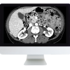 ARRS Gastrointestinal Imaging Online Course 2019 oc gi19 new 510x446 1