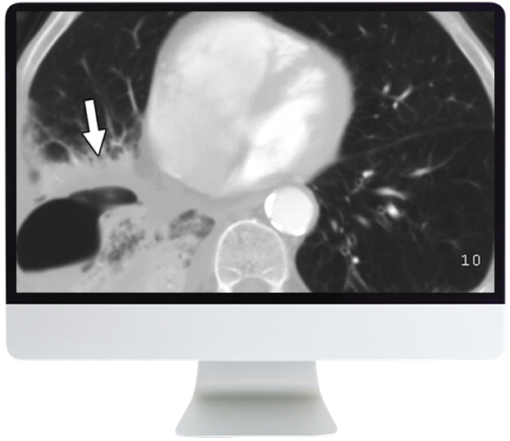 ARRS Radiology Review: Multispecialty Cases 2019 oc rc19 510x441 1