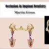 Occlusion in Implant Dentistry