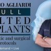 osteocom full tilted implants prosthetic and surgical protocols course