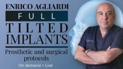 osteocom full tilted implants prosthetic and surgical protocols course