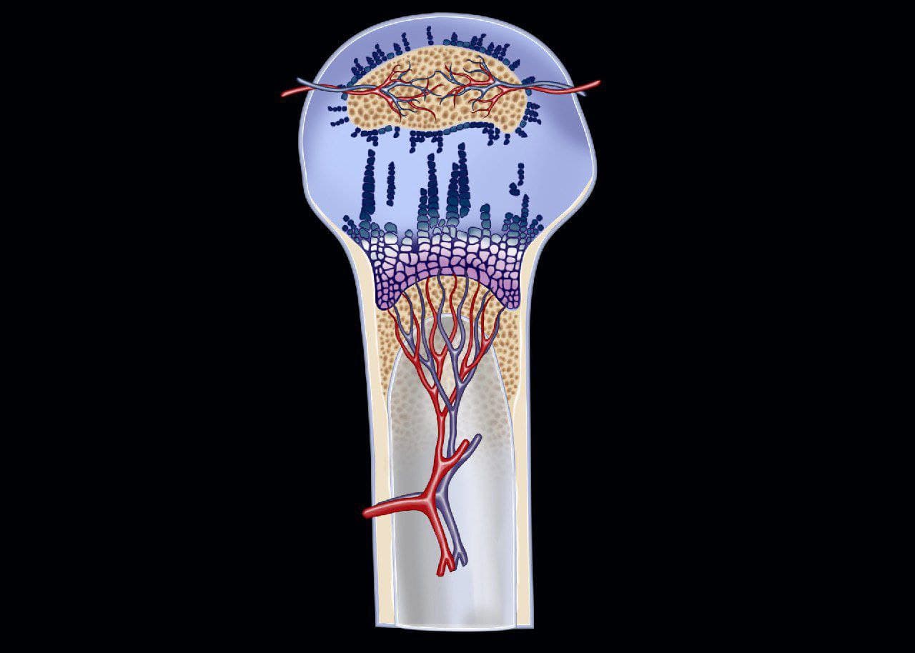 MRIOnline Imaging Mastery Series: Pediatric MSK 2021 photo 2021 11 05 10 59 28