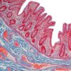 Current Topics in Gastrointestinal and Liver Pathology 2022 photo 2022 02 18 12 11 17