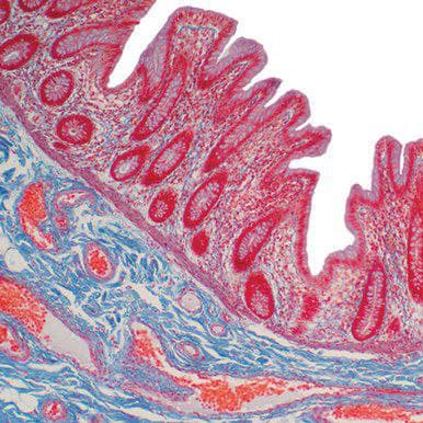 Current Topics in Gastrointestinal and Liver Pathology 2022 photo 2022 02 18 12 11 17