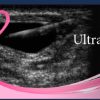 Pegasus Breast Ultrasound video course 2022 photo 2022 08 08 14 18 58