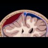 MRI Online Emergency Series: Emergency Neuroimaging: Brain 2021 photo 2022 08 29 15 16 50 510x510 1