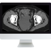 radiologic review lr 510x446 1
