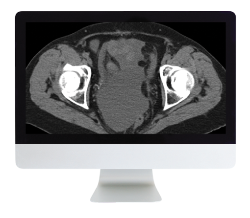 Radiologic Reasoning: A Rapid-Fire Multispecialty Review 2018 (ARRS VIDEOS) radiologic review lr 510x446 1