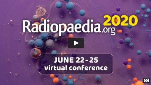 Radiopaedia 2020 – Virtual Conference screenshot 28 510x288 1