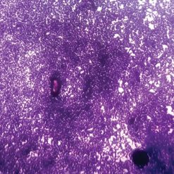 single topic cytopathology  15410 2