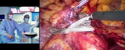 surgical Video Articles   JOMI Video Journal   Peer Reviewed 2023