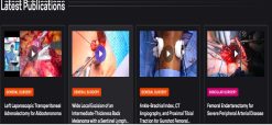 surgical Video Articles   JOMI Video Journal   Peer Reviewed