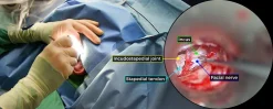 surgical Video Articles   JOMI Video Journal   Peer Reviewed3 2023