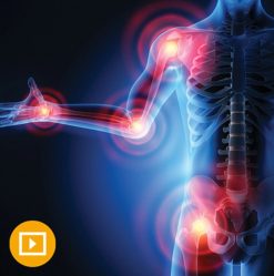 the brigham board review and comprehensive update in rheumatology 2022