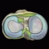thumbnail mri mastery series knee 510x480 1