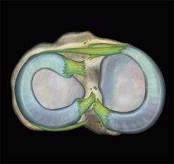 thumbnail mri mastery series knee 510x480 1