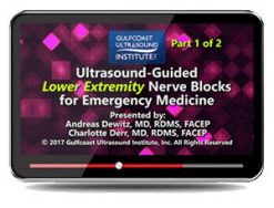 ultrasound guided lower extremity nerve blocks