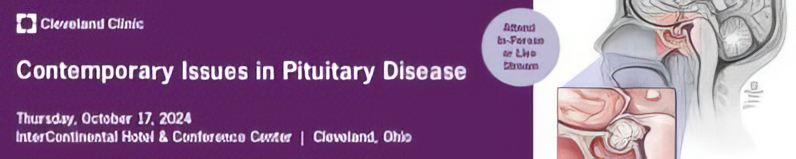 Cleveland Clinic Contemporary Issues In Pituitary Disease 2024 Cleveland Clinic Contemporary Issues In Pituitary Disease 2024