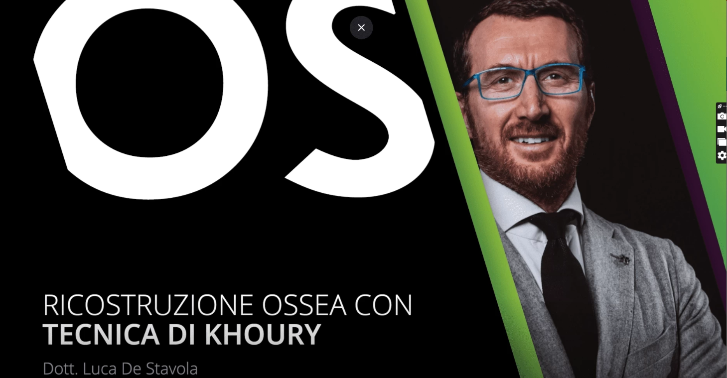 Ricostruzione ossea con tecnica di Khoury (Italiano) Dott. Luca De Stavola Ricostruzione ossea con tecnica di Khoury (Italiano) Dott. Luca De Stavola