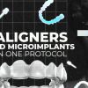 OHI-S Aligners And Microimplants In One Protocol OHI-S Aligners And Microimplants In One Protocol