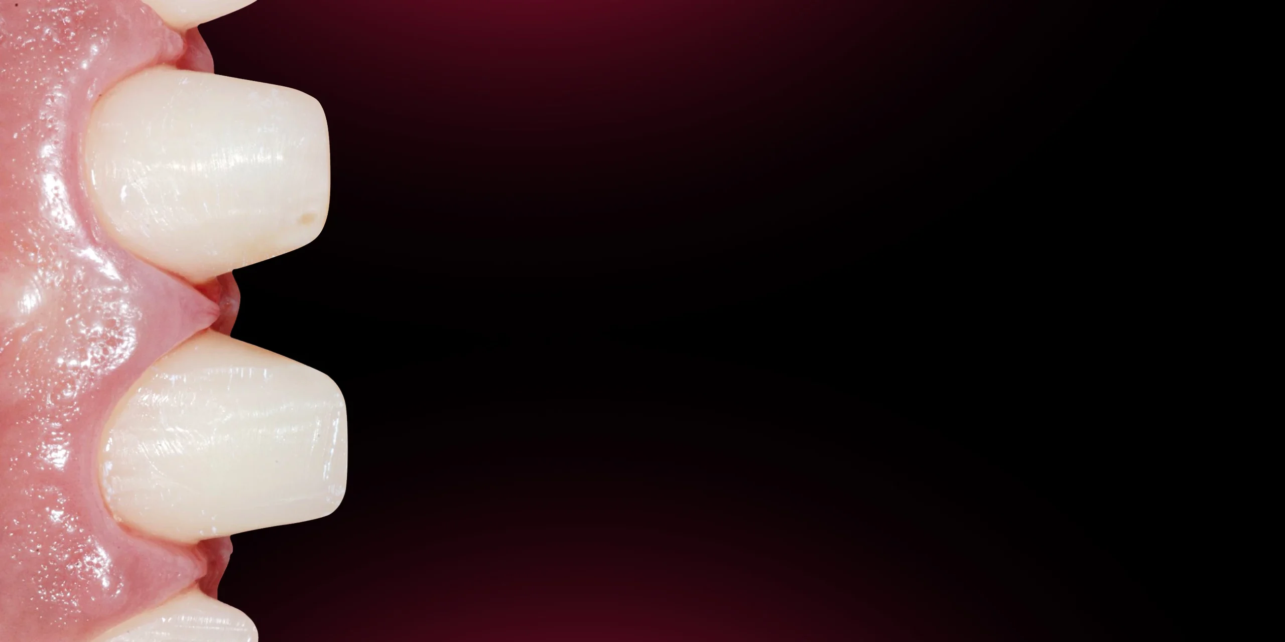 OHI-S Aesthetic Dentistry Online Congress OHI-S Aesthetic Dentistry Online Congress