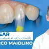 OHI-S Bioclear Dental Restoration Method With Dr. Marco Maiolino OHI-S Bioclear Dental Restoration Method With Dr. Marco Maiolino