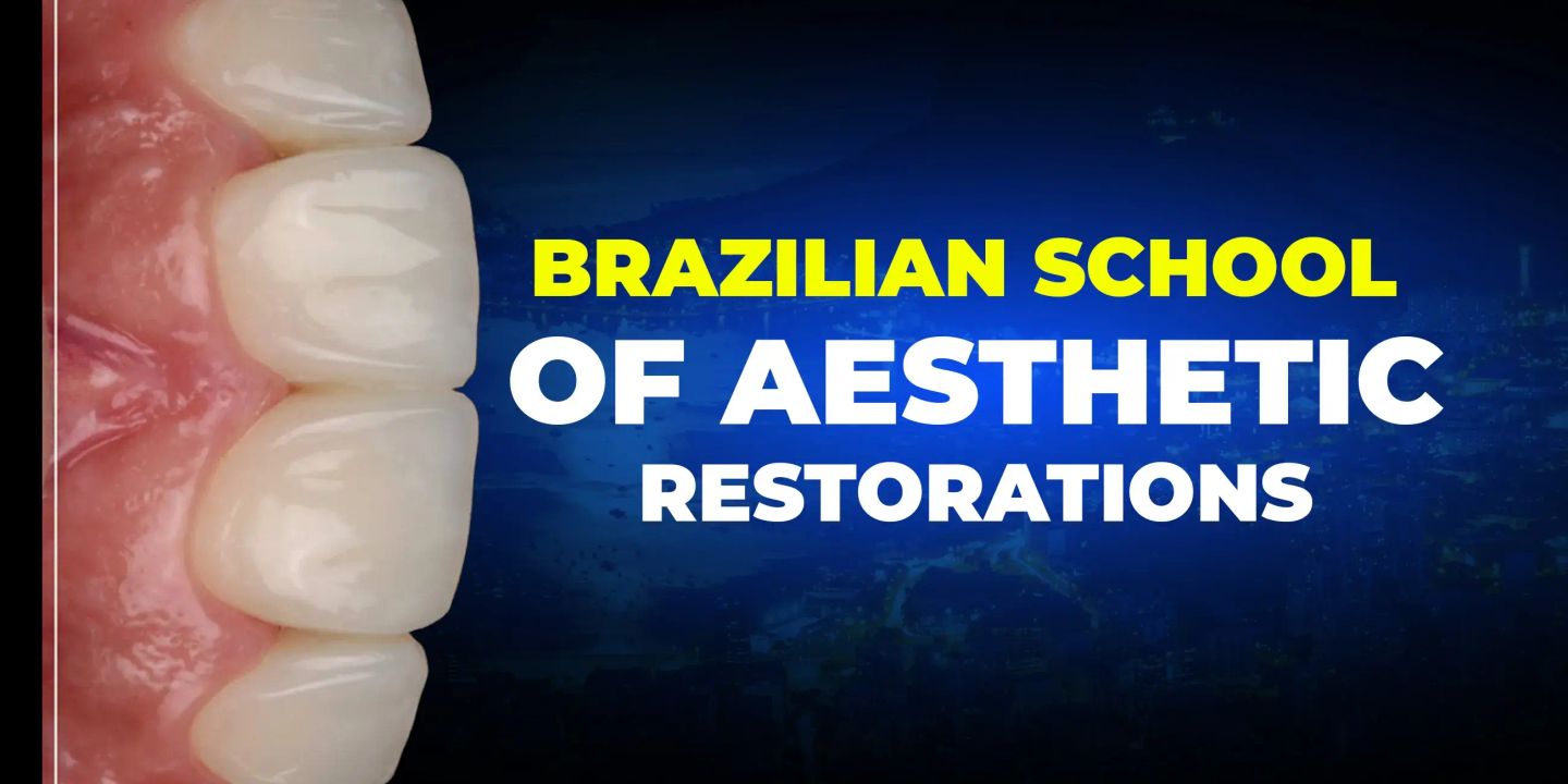 OHI-S Brazilian School of Aesthetic Restorations OHI-S Brazilian School of Aesthetic Restorations