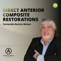 Osteocom – Direct Anterior Composite Restoration