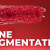 OHI-S Bone Augmentation Current Techniques