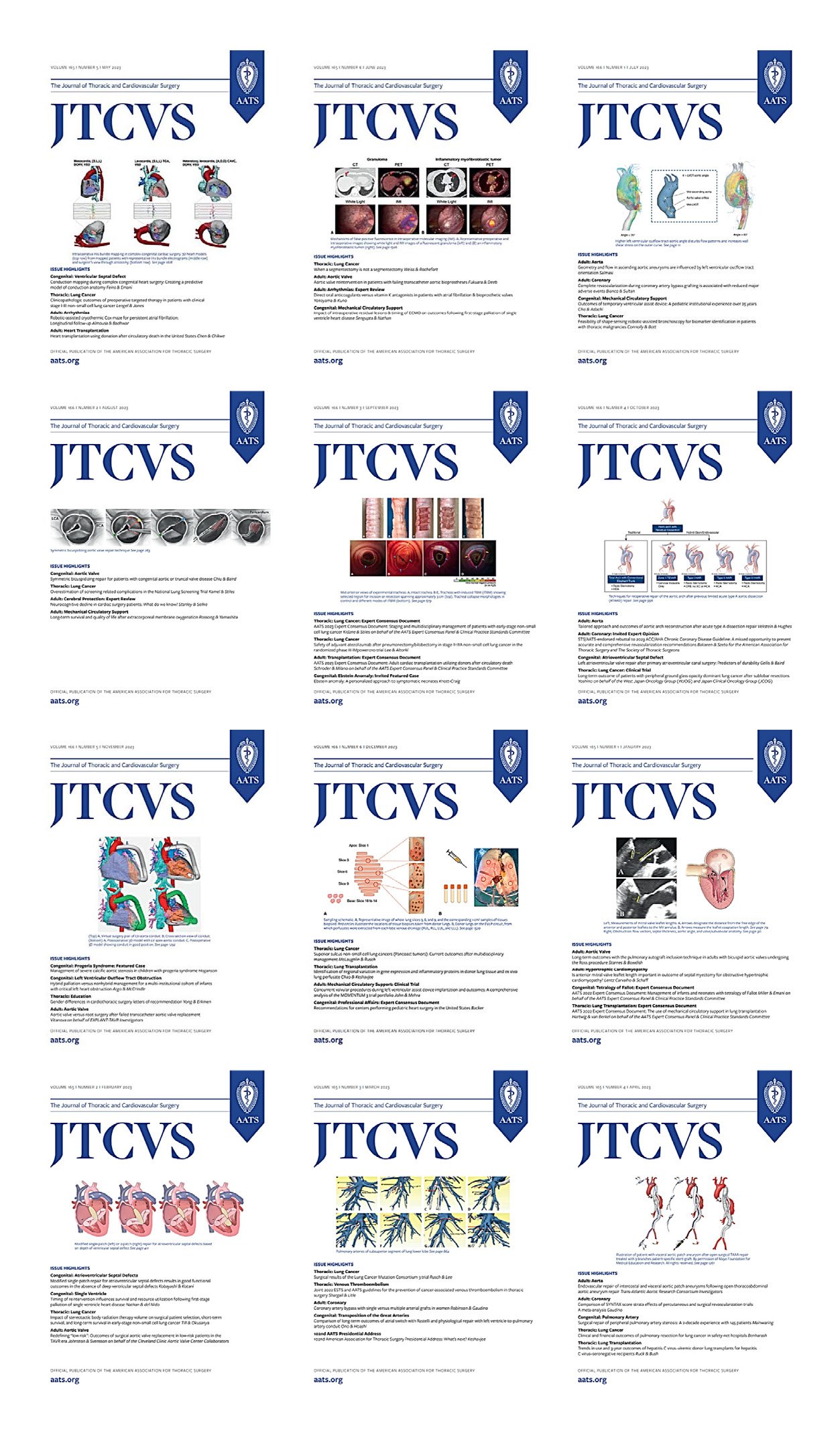 The Journal of Thoracic and Cardiovascular Surgery 2023 Full Archives (True PDF) The Journal of Thoracic and Cardiovascular Surgery 2023 Full Archives (True PDF)