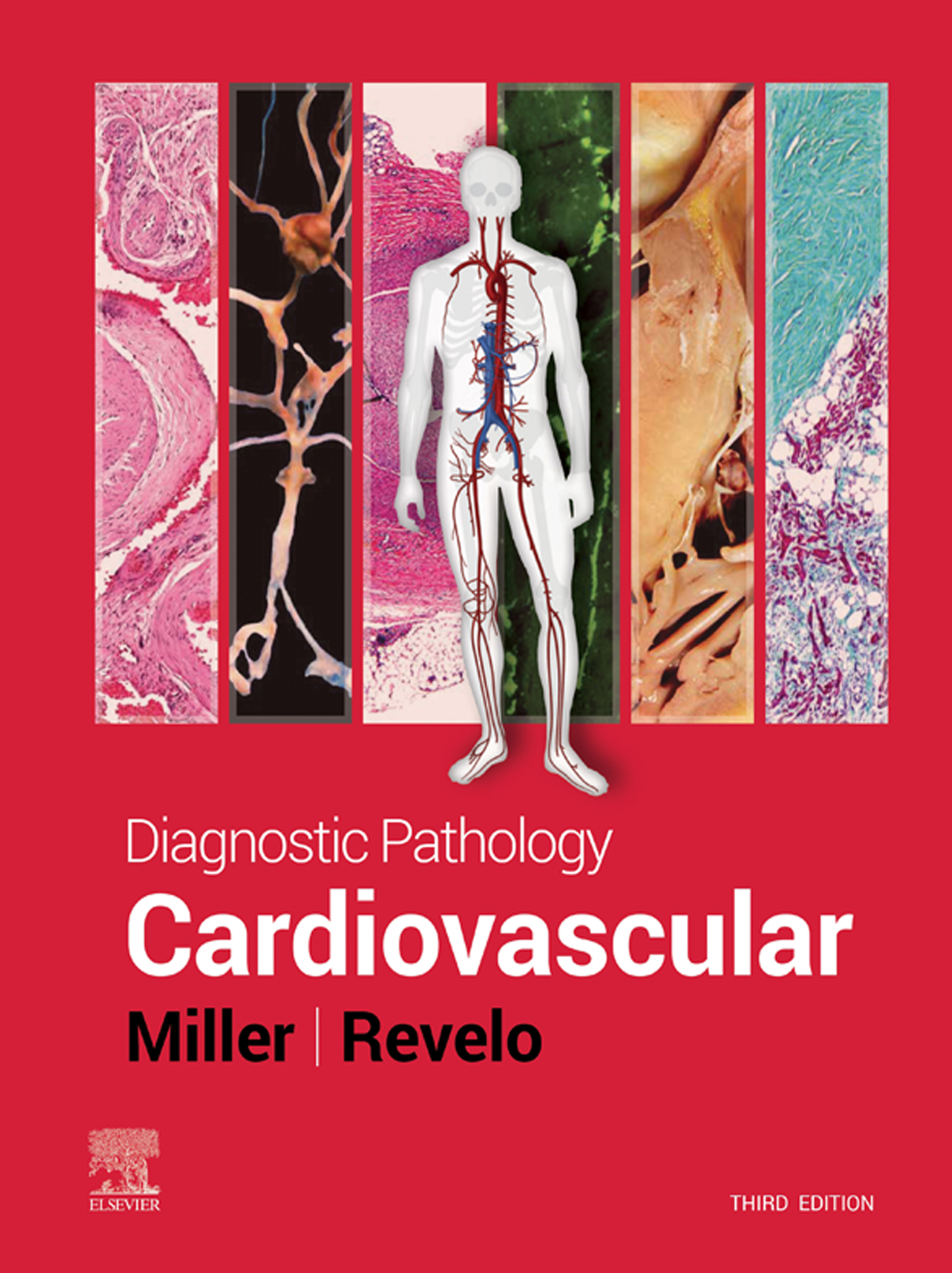 Diagnostic Pathology: Cardiovascular, 3rd Edition (EPUB and pdf) Diagnostic Pathology: Cardiovascular, 3rd Edition (EPUB)