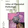 Atlas of Placental Pathology (AFIP Atlas of Tumor and Non-Tumor Pathology, Series 5, Volume 6) (Original PDF from Publisher) Atlas of Placental Pathology (AFIP Atlas of Tumor and Non-Tumor Pathology, Series 5, Volume 6) (Original PDF from Publisher)