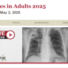 Harvard Infectious Diseases in Adults 2025 harvard Infectious Diseases in Adults 2025
