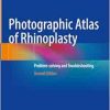 Photographic Atlas of Rhinoplasty: Problem-solving and Troubleshooting, 2nd Edition pdf and videos Photographic Atlas of Rhinoplasty