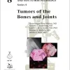 Tumors of the Bones and Joints (AFIP Atlases of Tumor and Non-tumor Pathology, Series 5, Volume 8) (Original PDF from Publisher) Tumors of the Bones and Joints (AFIP Atlases of Tumor and Non-tumor Pathology, Series 5, Volume 8) (Original PDF from Publisher)