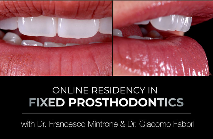 gIDE Institute Online Certificate Program in Fixed Prosthodontics – Esthetic and Functional Rehabilitation of Natural Teeth gIDE Institute Online Certificate Program in Fixed Prosthodontics – Esthetic and Functional Rehabilitation of Natural Teeth