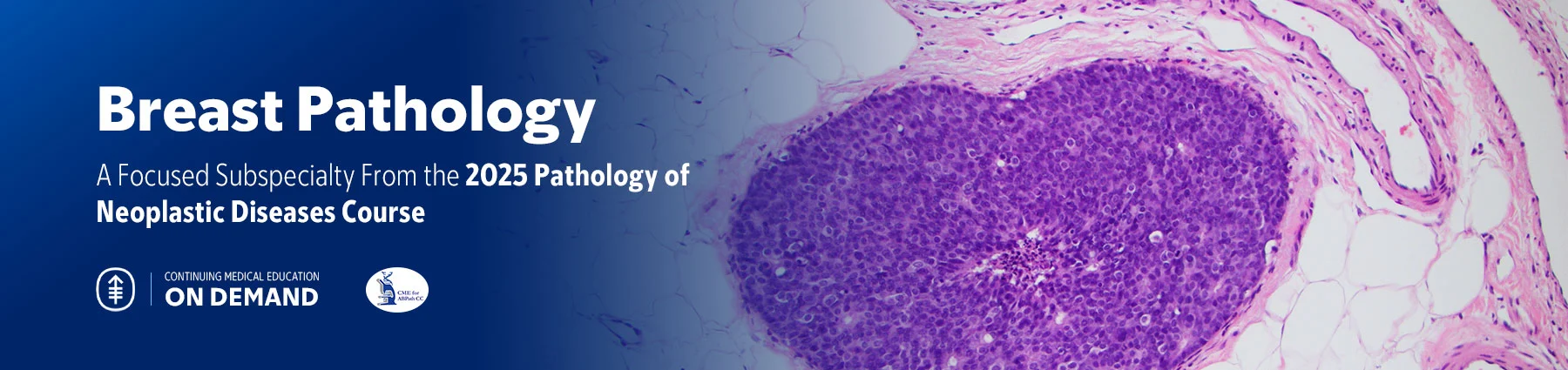 Breast Pathology – The Pathology of Neoplastic Diseases 2025 (Videos with subtitles + Slides) Breast Pathology – The Pathology of Neoplastic Diseases 2025 (Videos with subtitles + Slides)