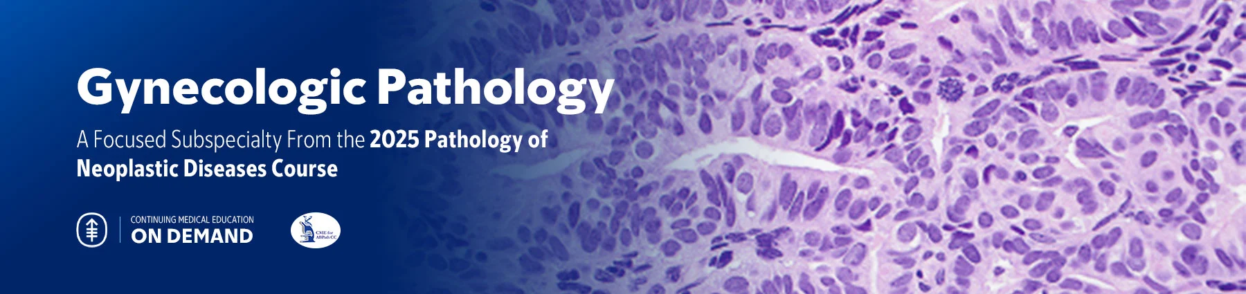 Gynecologic Pathology – The Pathology of Neoplastic Diseases 2025 (Videos with subtitles + Slides) Gynecologic Pathology – The Pathology of Neoplastic Diseases 2025 (Videos with subtitles + Slides)