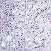 Cleveland Clinic Comprehensive and Immersive Soft Tissue Pathology 2025 Cleveland Clinic Comprehensive and Immersive Soft Tissue Pathology 2025