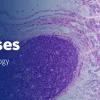 The Pathology of Neoplastic Diseases 2025 (Videos with subtitles + Slides) The Pathology of Neoplastic Diseases 2025 (Videos with subtitles + Slides)