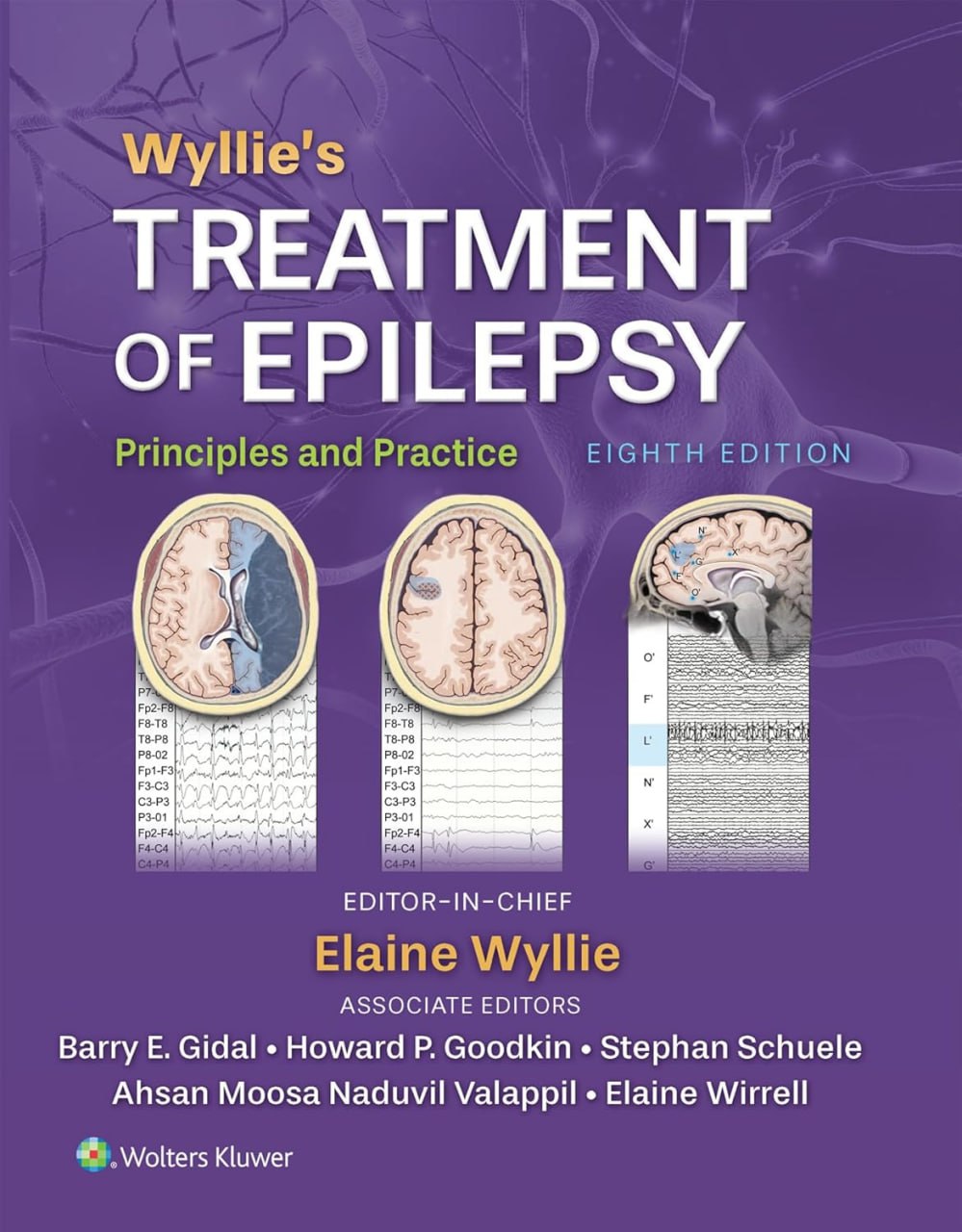 Wyllie’s Treatment of Epilepsy: Principles and Practice, 8th edition (Videos Only) Wyllie’s Treatment of Epilepsy: Principles and Practice, 8th Edition EPUD and converted pdf