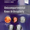 Unicompartmental Knee Arthroplasty (Original PDF from Publisher) Unicompartmental Knee Arthroplasty (Original PDF from Publisher)