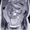 UCSF ObGyn Women’s Imaging 2025 (Videos + Slides PDFs) UCSF ObGyn Women’s Imaging 2025 (Videos + Slides PDFs)